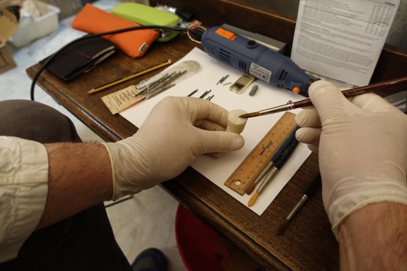 Ricollocazione anulare mano destra Santa Bibiana di Bernini