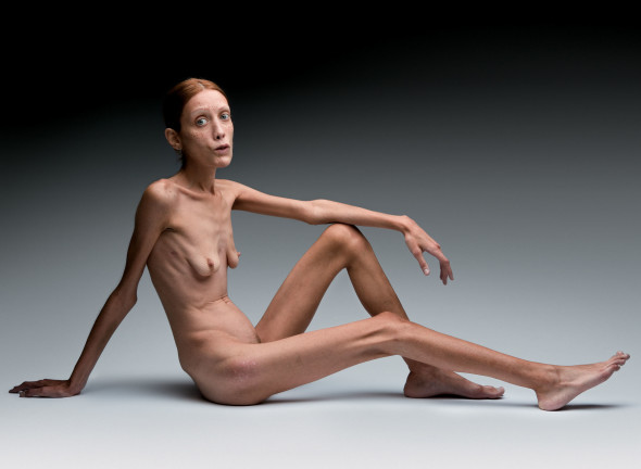Oliviero Toscani, No Anorexia, Campagna pubblicitaria, 2007 © Studio Toscani